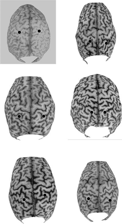 Hemispheric Asymmetry in the Remapping and image