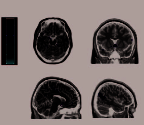 The Neural Correlates of Persuasion: A Common Network image