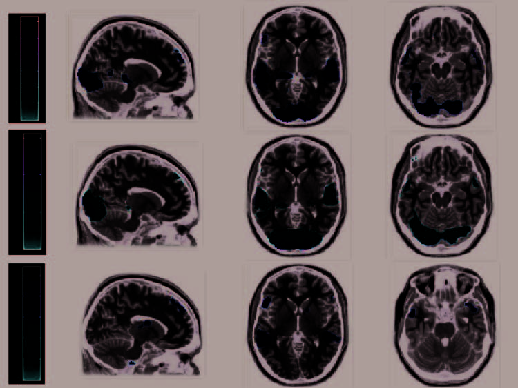 The Neural Correlates of Persuasion: A Common Network image