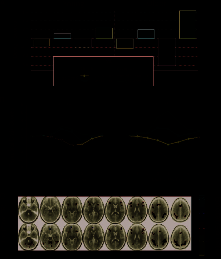 Overrecruitment in the Aging Brain as a Function image