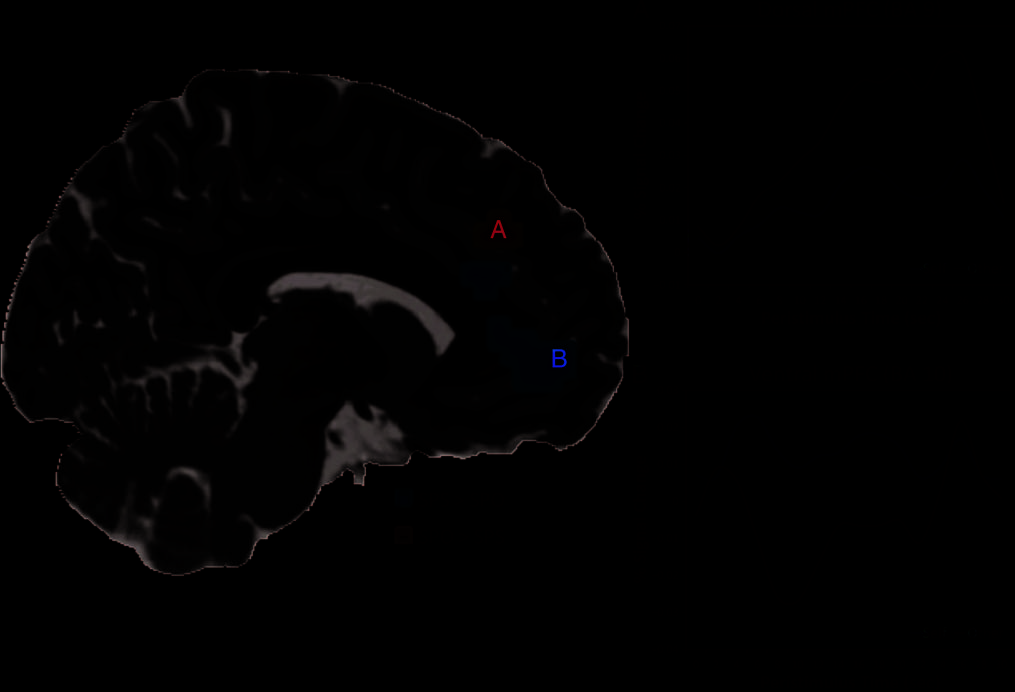 Watching My Mind Unfold versus Yours: An fMRI Study image