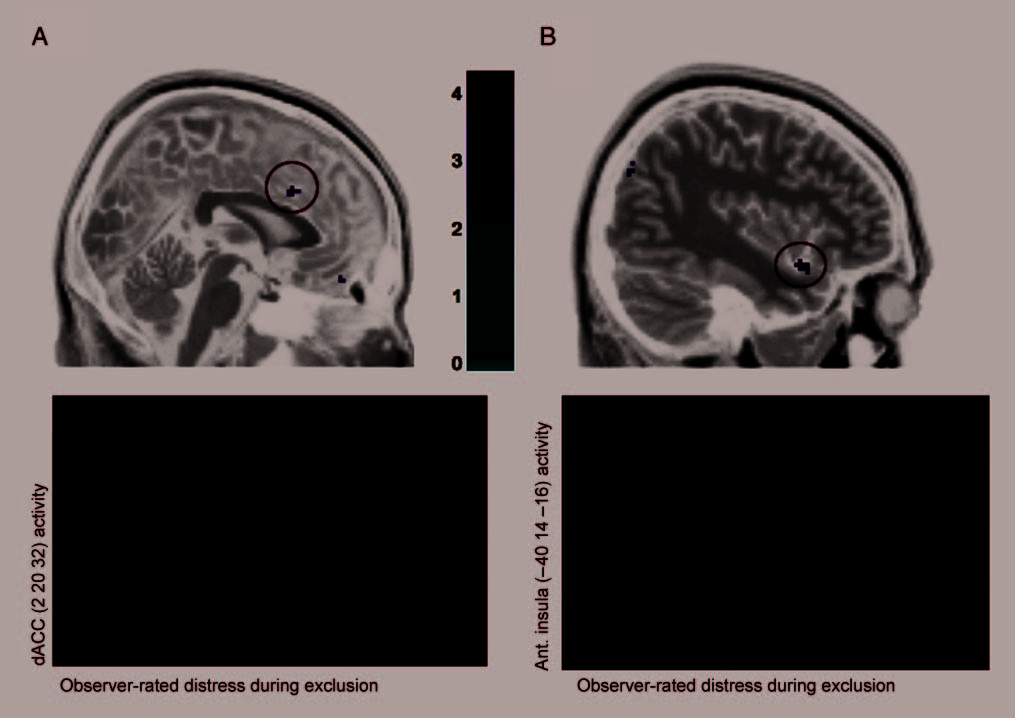 An fMRI Investigation of Attributing Negative Social image