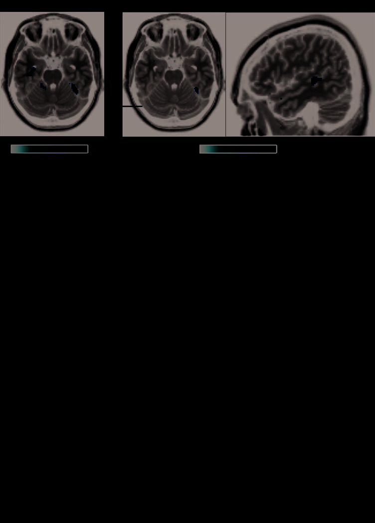 Fusiform Gyrus Face Selectivity Relates to Individual image