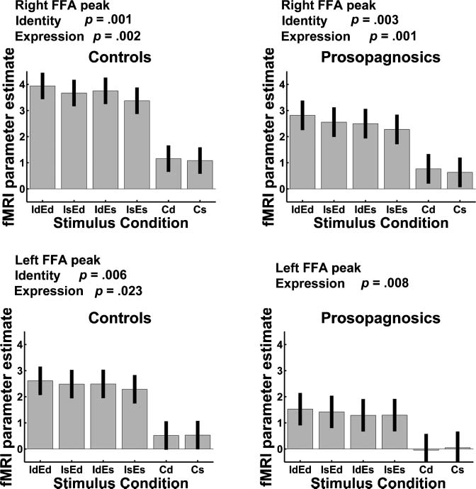 Fusiform Gyrus Face Selectivity Relates to Individual image