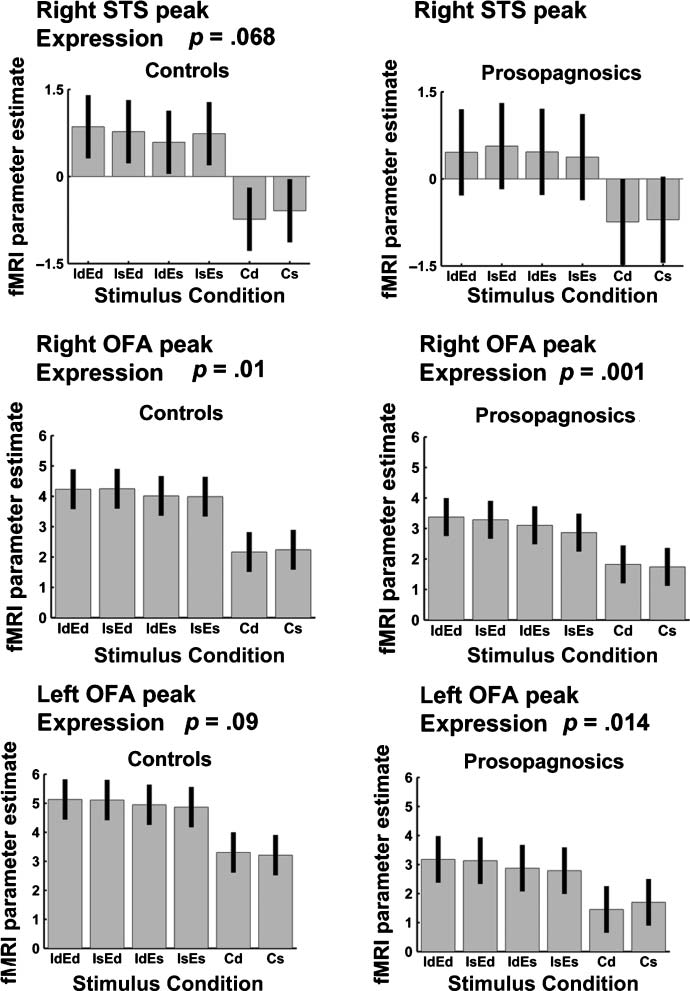 Fusiform Gyrus Face Selectivity Relates to Individual image