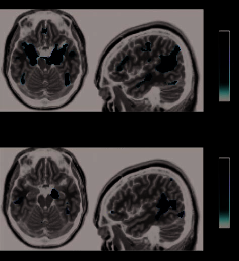 Fusiform Gyrus Face Selectivity Relates to Individual image