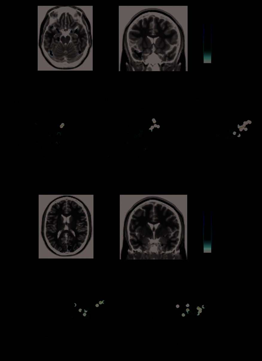 Fusiform Gyrus Face Selectivity Relates to Individual image