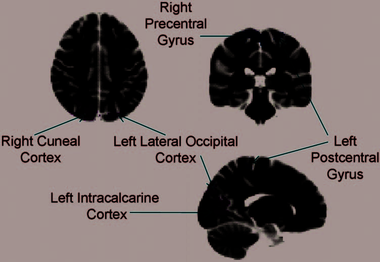 Active Ignoring in Early Visual Cortex image