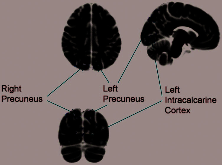 Active Ignoring in Early Visual Cortex image