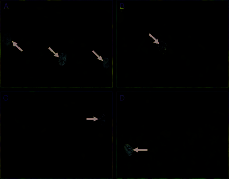 Learning Increases the Survival of Newborn image