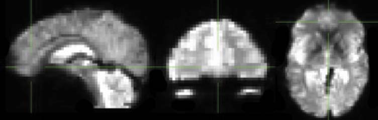 Is Morality Unified? Evidence that Distinct Neural image