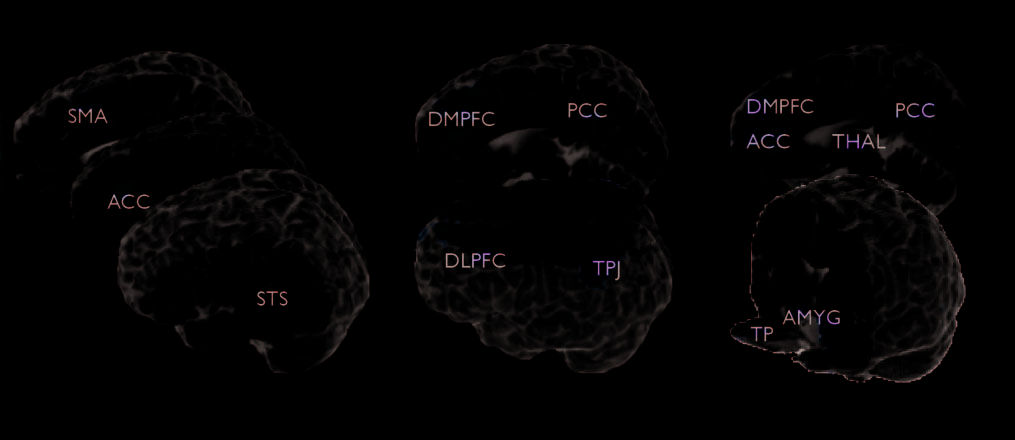 Is Morality Unified? Evidence that Distinct Neural image