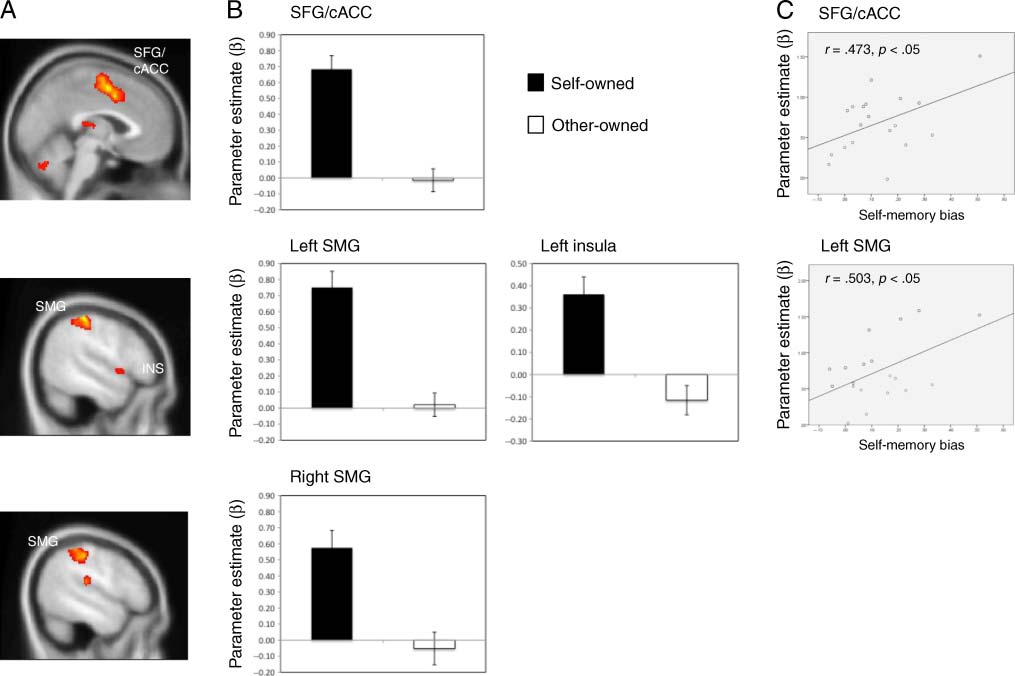 Mine and Me: Exploring the Neural Basis of image