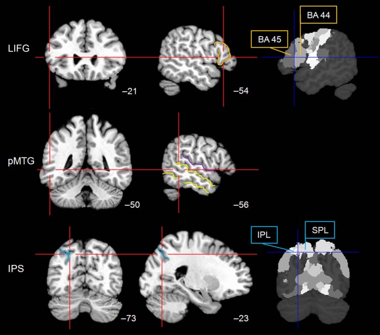 Executive Semantic Processing Is Underpinned by image