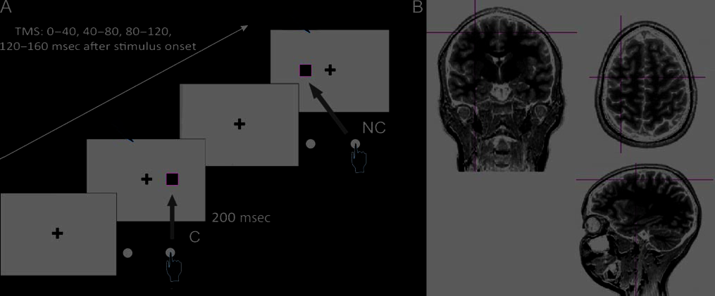 TMS of the FEF Interferes with Spatial Conflict image