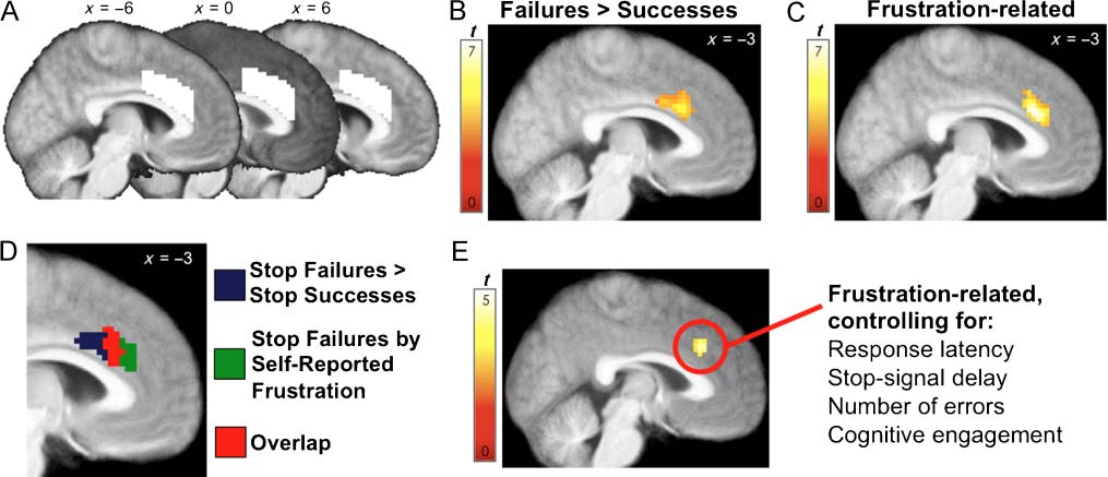 The Phenomenology of Error Processing: The Dorsal image