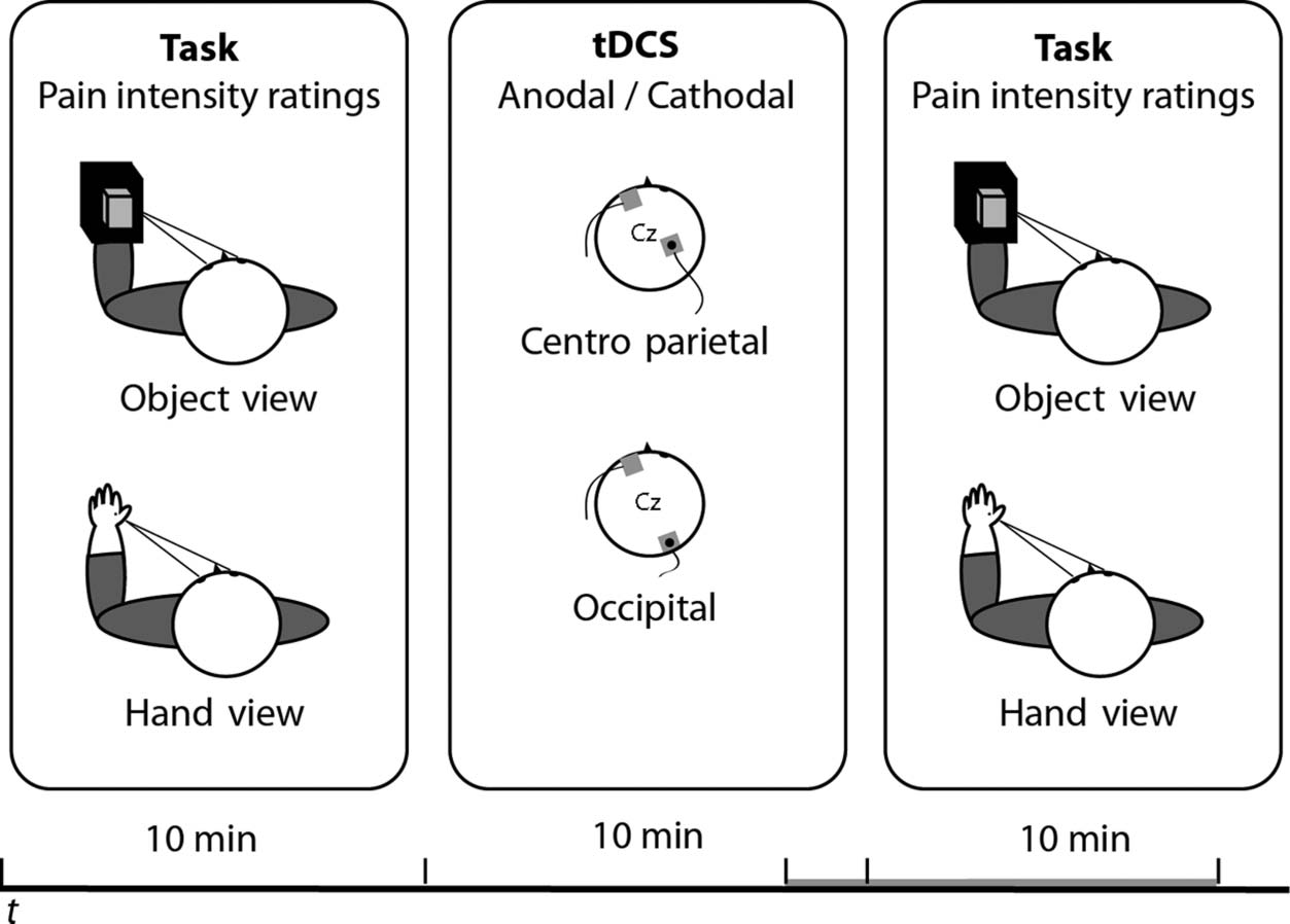 tDCS Modulation of Visually Induced Analgesia image