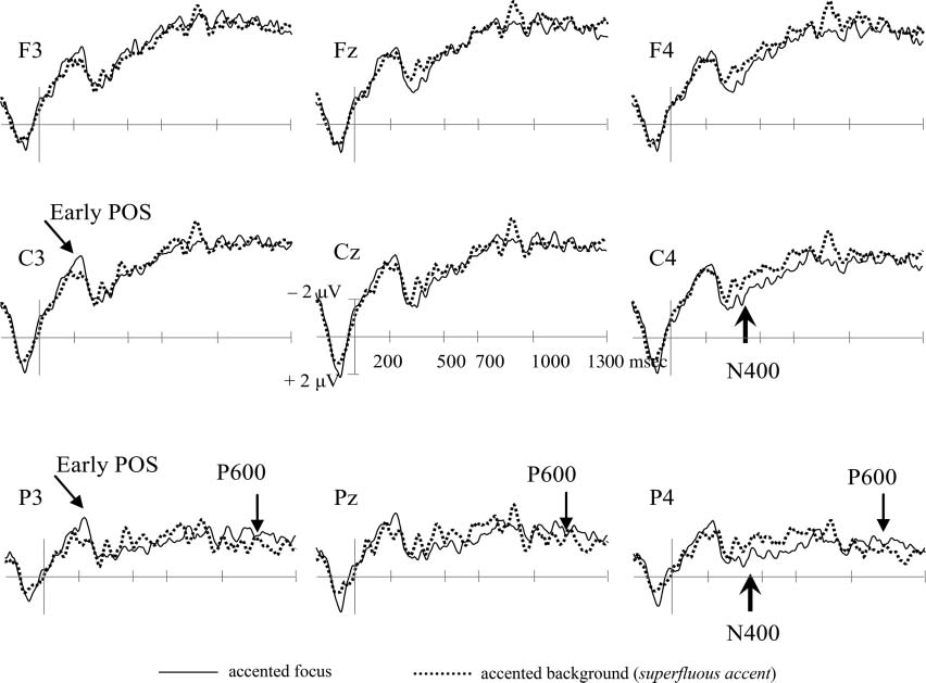 Less Is Not More: Neural Responses to Missing and image