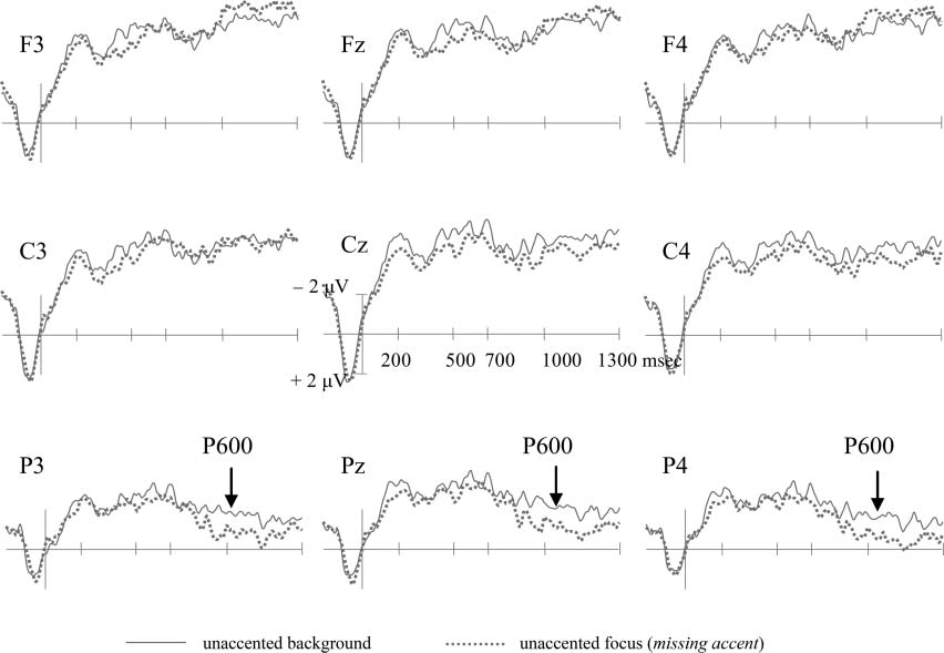 Less Is Not More: Neural Responses to Missing and image