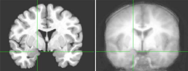 Amygdala Sensitivity to Race Is Not Present in image