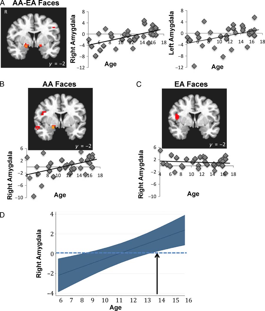 Amygdala Sensitivity to Race Is Not Present in image