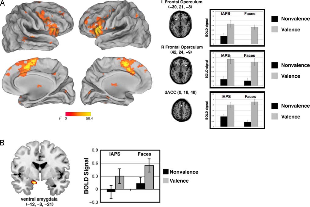 Neural Responses to Ambiguity Involve Domain-general image