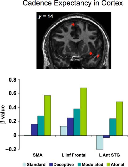 Corticostriatal Contributions to Musical image