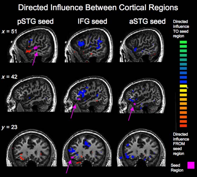 Corticostriatal Contributions to Musical image