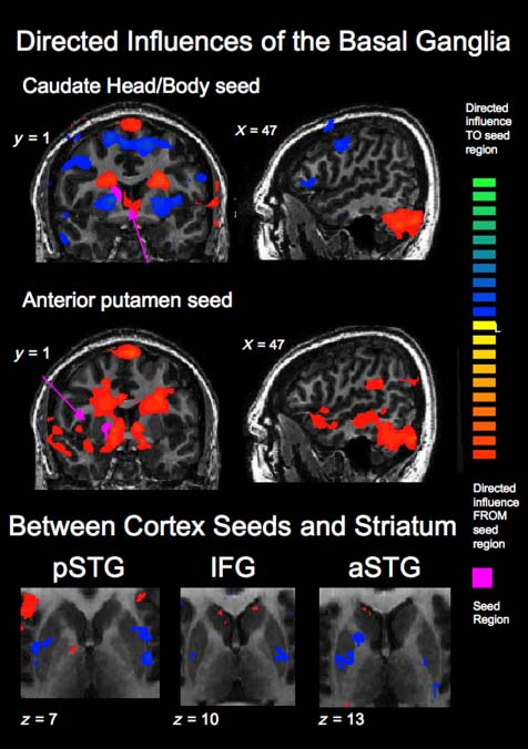 Corticostriatal Contributions to Musical image