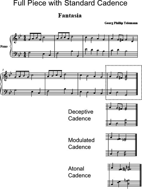 Corticostriatal Contributions to Musical image