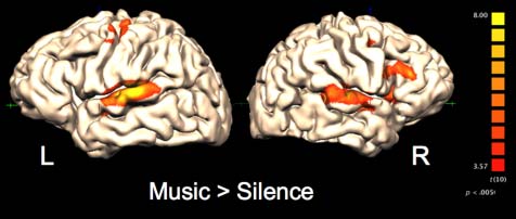 Corticostriatal Contributions to Musical image