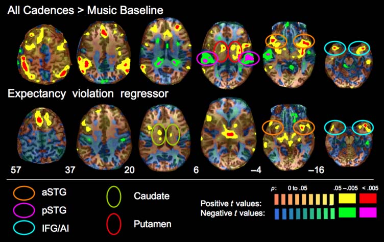 Corticostriatal Contributions to Musical image