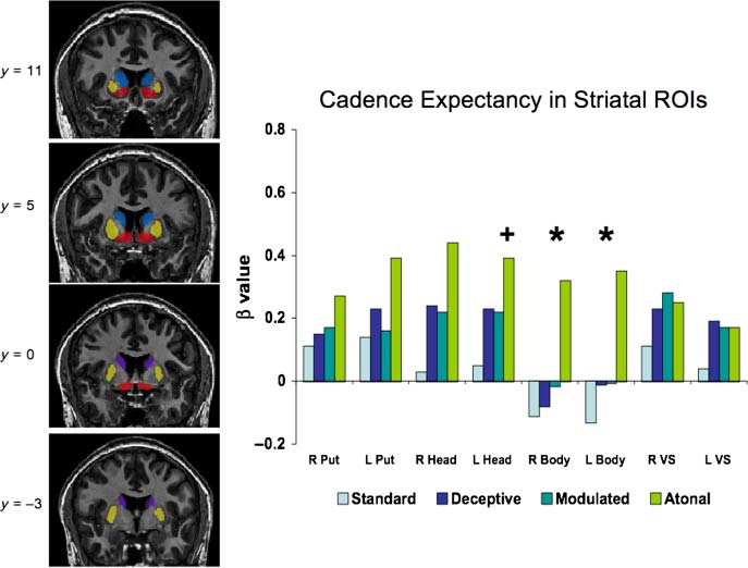 Corticostriatal Contributions to Musical image