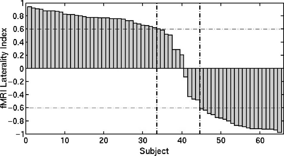 A Surface-based Analysis of Language Lateralization image