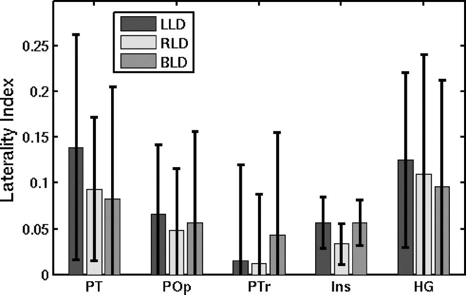 A Surface-based Analysis of Language Lateralization image