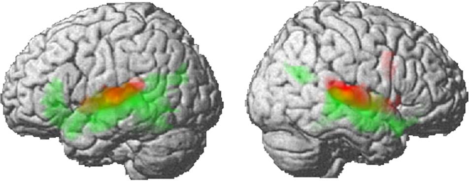 Neurobiological Systems for Lexical Representation image