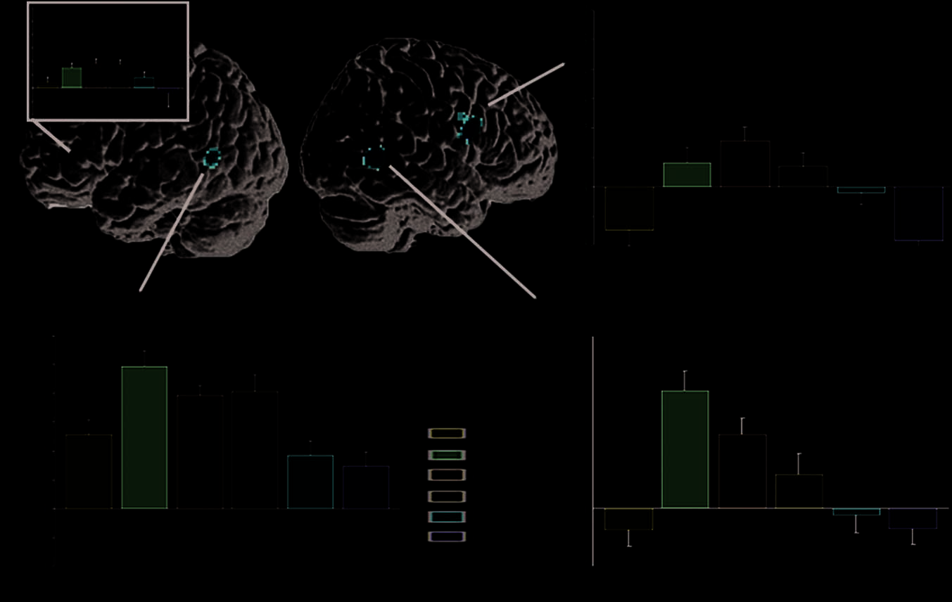 Neurobiological Systems for Lexical Representation image