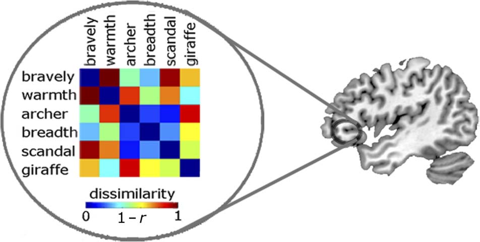 Neurobiological Systems for Lexical Representation image