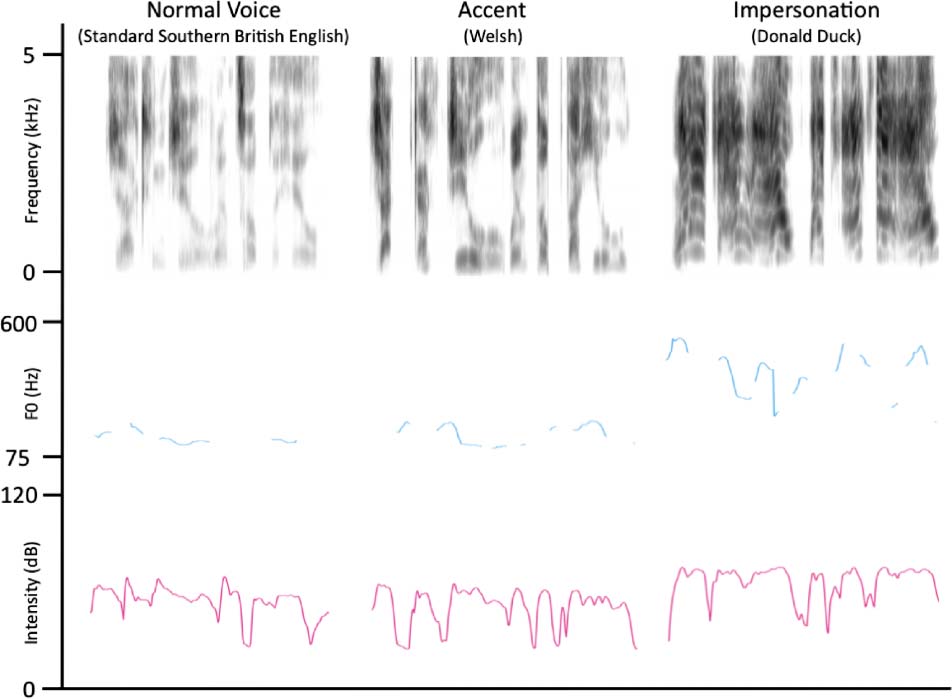 Tʼainʼt What You Say, Itʼs the Way That You Say It—Left Insula image