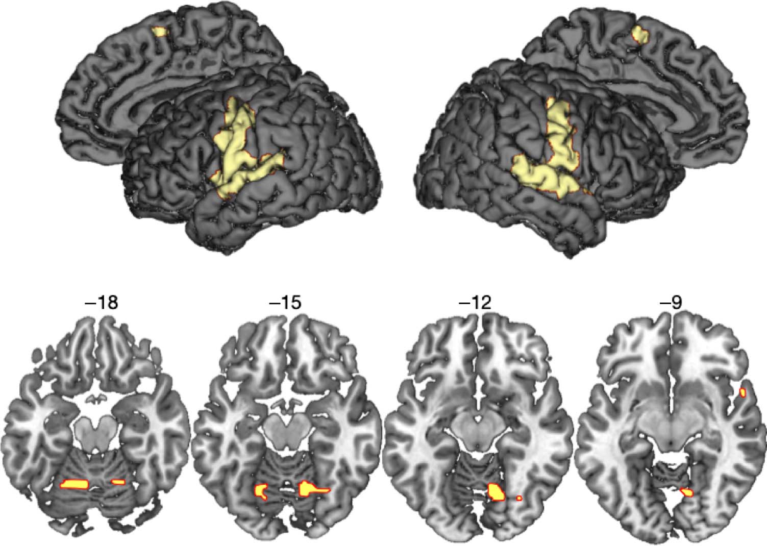 Tʼainʼt What You Say, Itʼs the Way That You Say It—Left Insula image