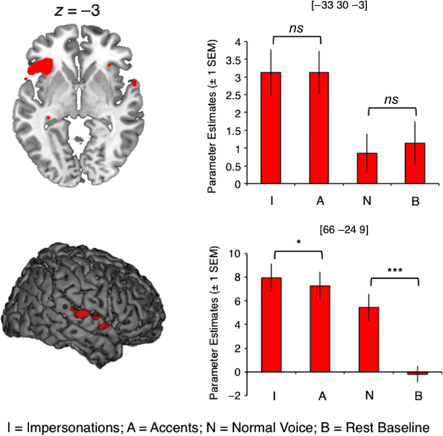 Tʼainʼt What You Say, Itʼs the Way That You Say It—Left Insula image