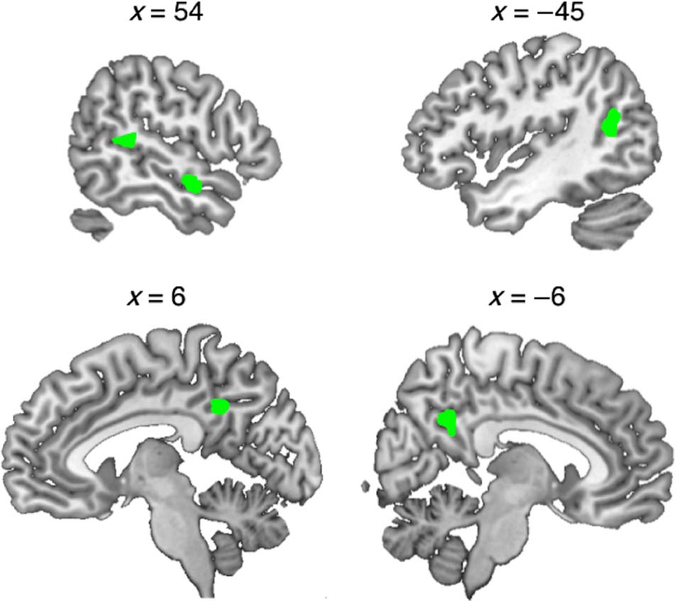 Tʼainʼt What You Say, Itʼs the Way That You Say It—Left Insula image