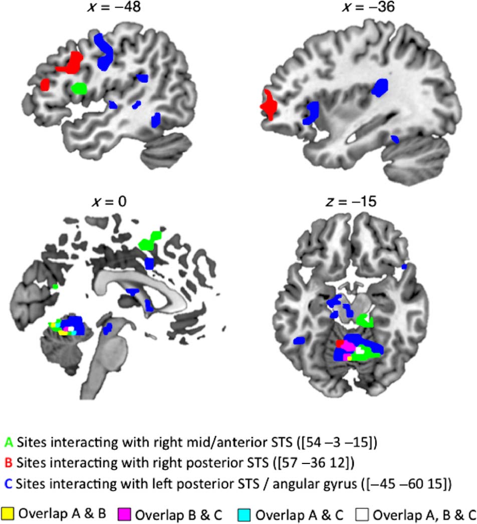 Tʼainʼt What You Say, Itʼs the Way That You Say It—Left Insula image