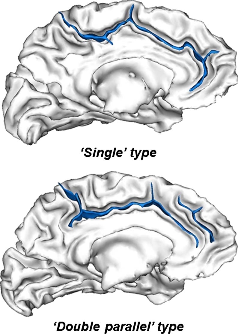 The Shape of the ACC Contributes to Cognitive image