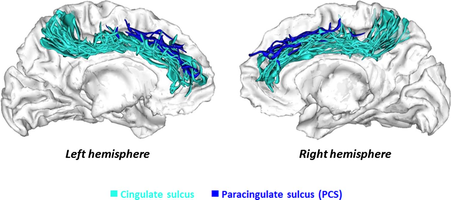 The Shape of the ACC Contributes to Cognitive image