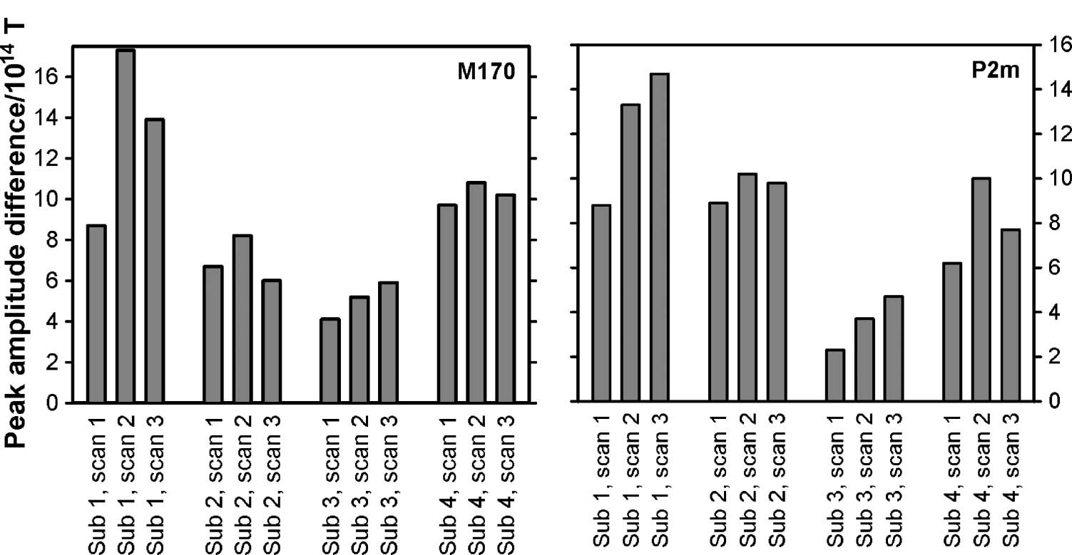 Magnetoencephalographic Activity Related to Conscious image