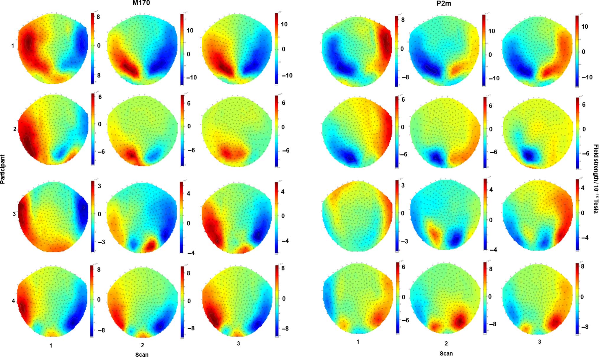 Magnetoencephalographic Activity Related to Conscious image