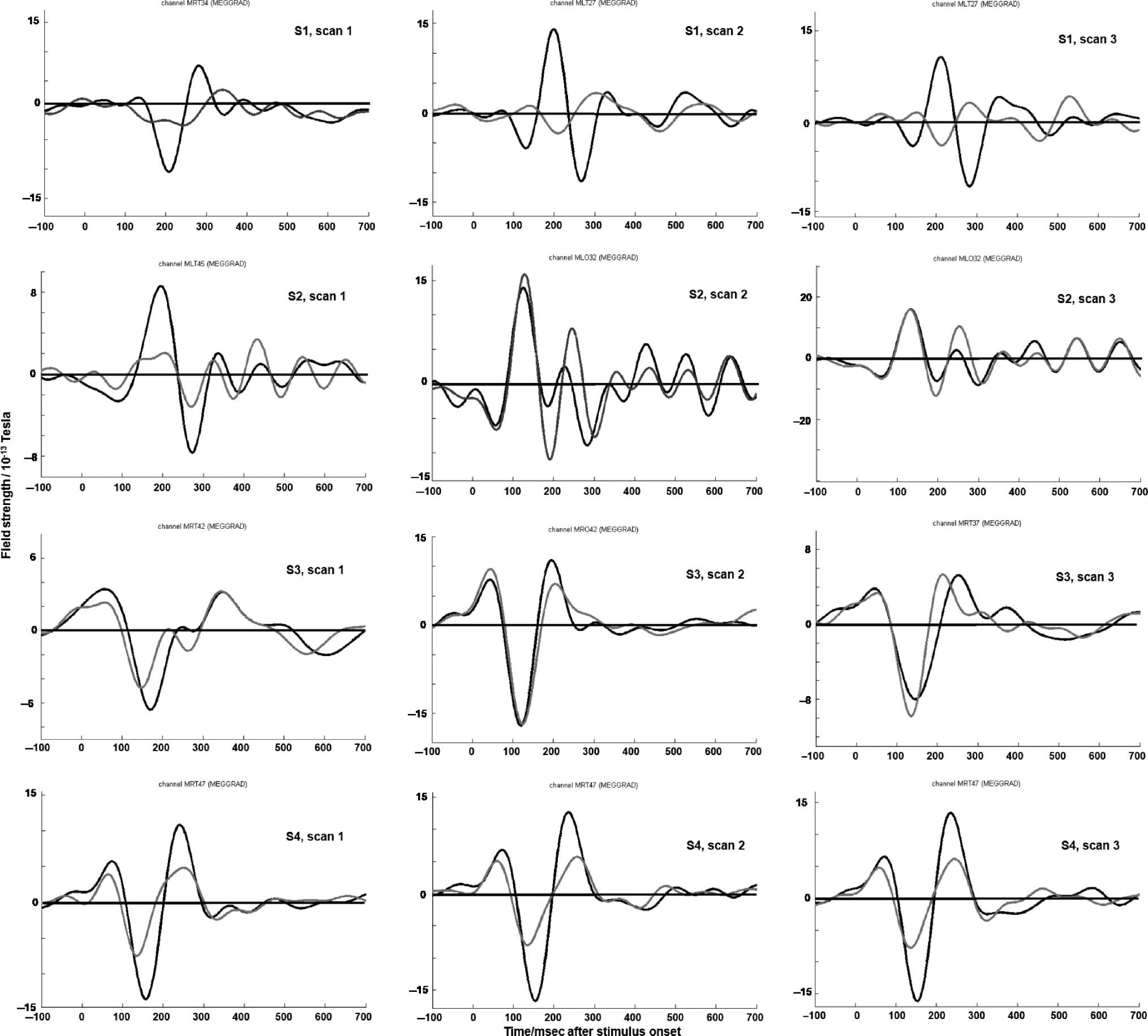 Magnetoencephalographic Activity Related to Conscious image