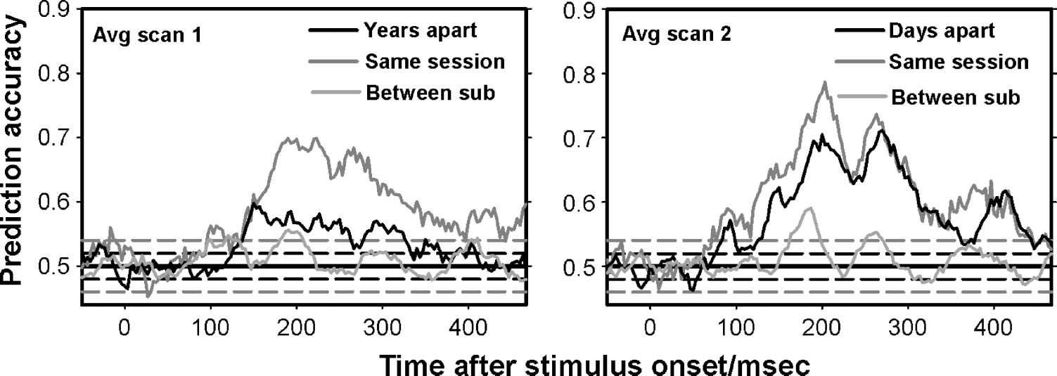 Magnetoencephalographic Activity Related to Conscious image