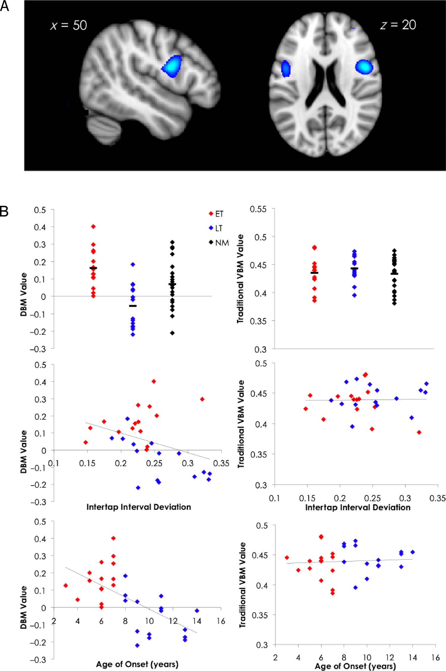 Early Musical Training Is Linked to Gray Matter Structure image